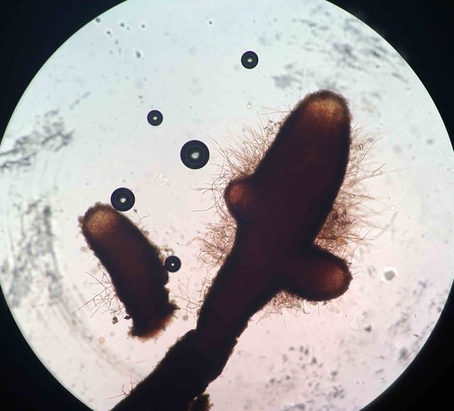 microscope view of TM hyphe